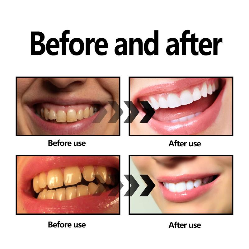 Teeth Whitening Powder Charcoa - Teeth Whitening Baking Soda review and price