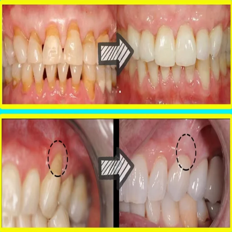 Quickly Repair Gum Serum Relie - Teeth Whitening Baking Soda review and price