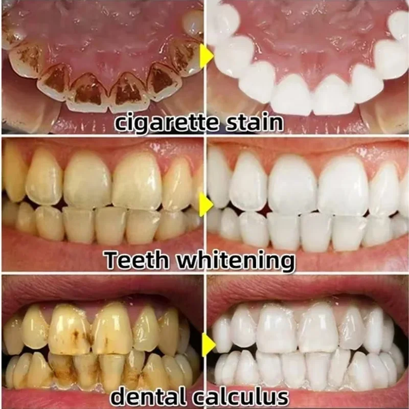 Quickly Repair Gum Serum Relie - Teeth Whitening Baking Soda review and price