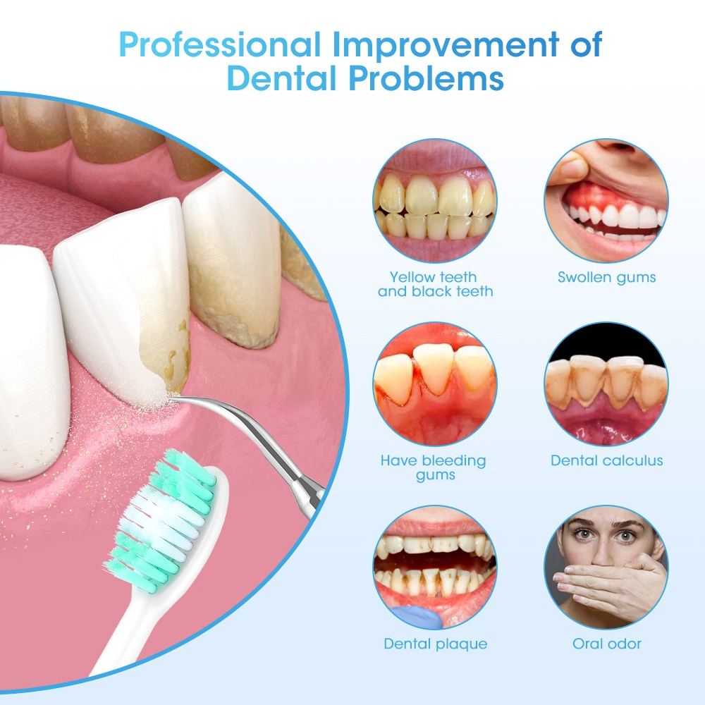 LC-H156X Electric Teeth Whiten - Teeth Whitening And Stain Removal review and price