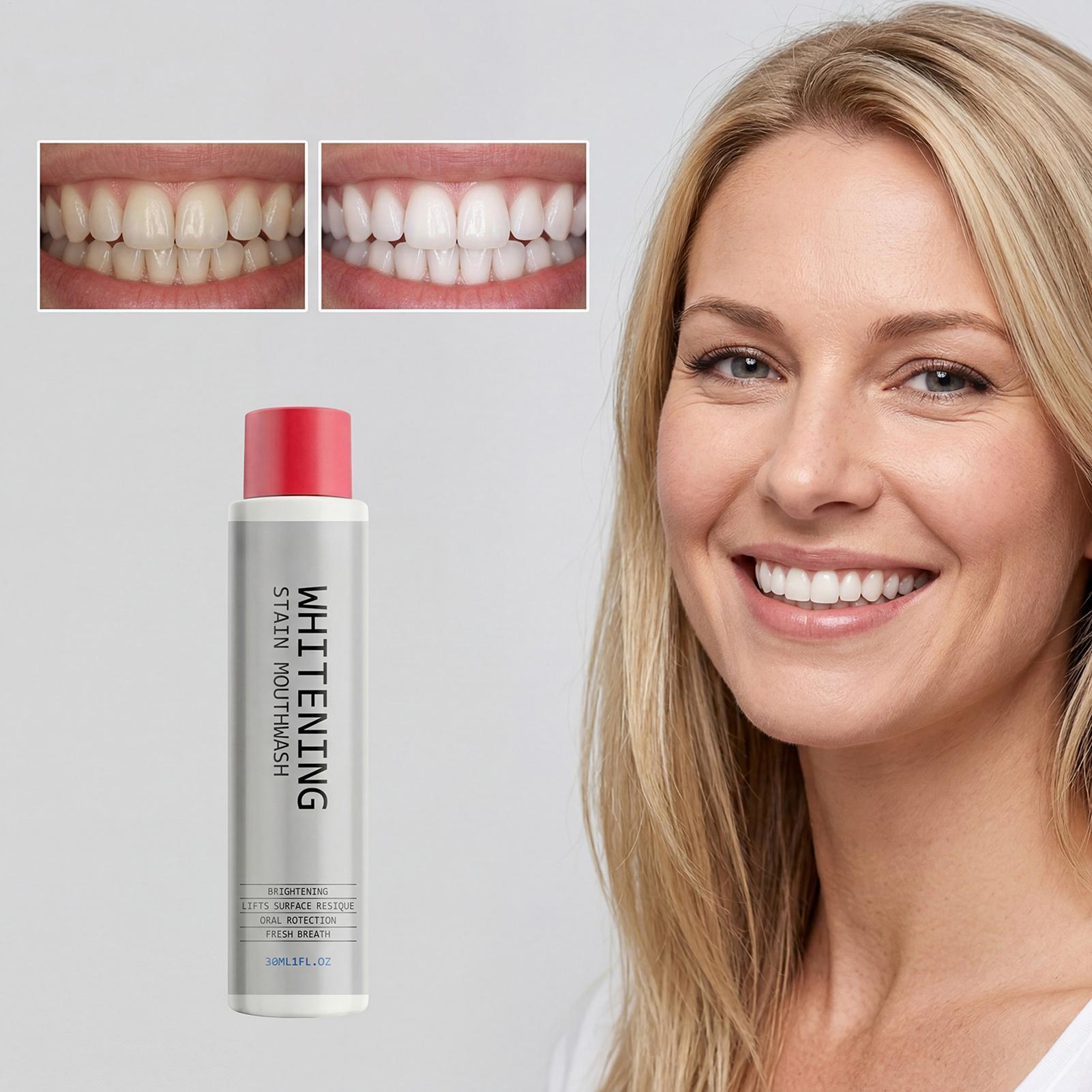 30ml Stain Whitening Mouthwash - Teeth Whitening And Stain Removal review and price