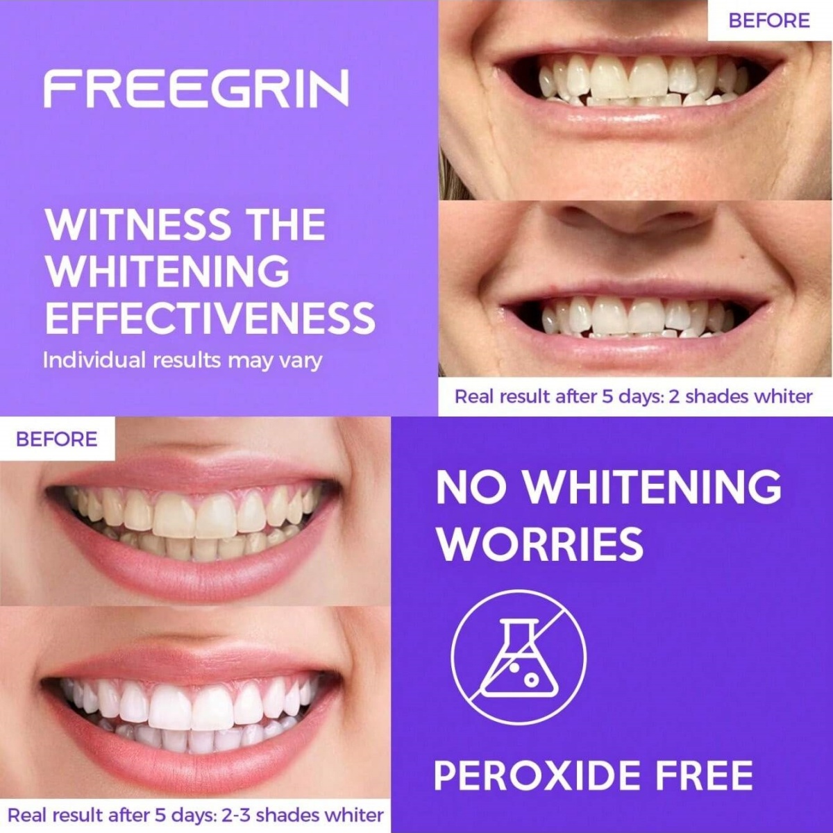 Deluxe Whitening Teeth Sticker - Teeth Whitening Essence review and price
