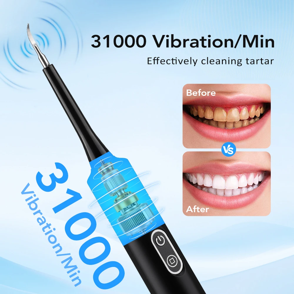 Electric Sonic Vibration Denta - Teeth Whitening And Stain Removal review and price